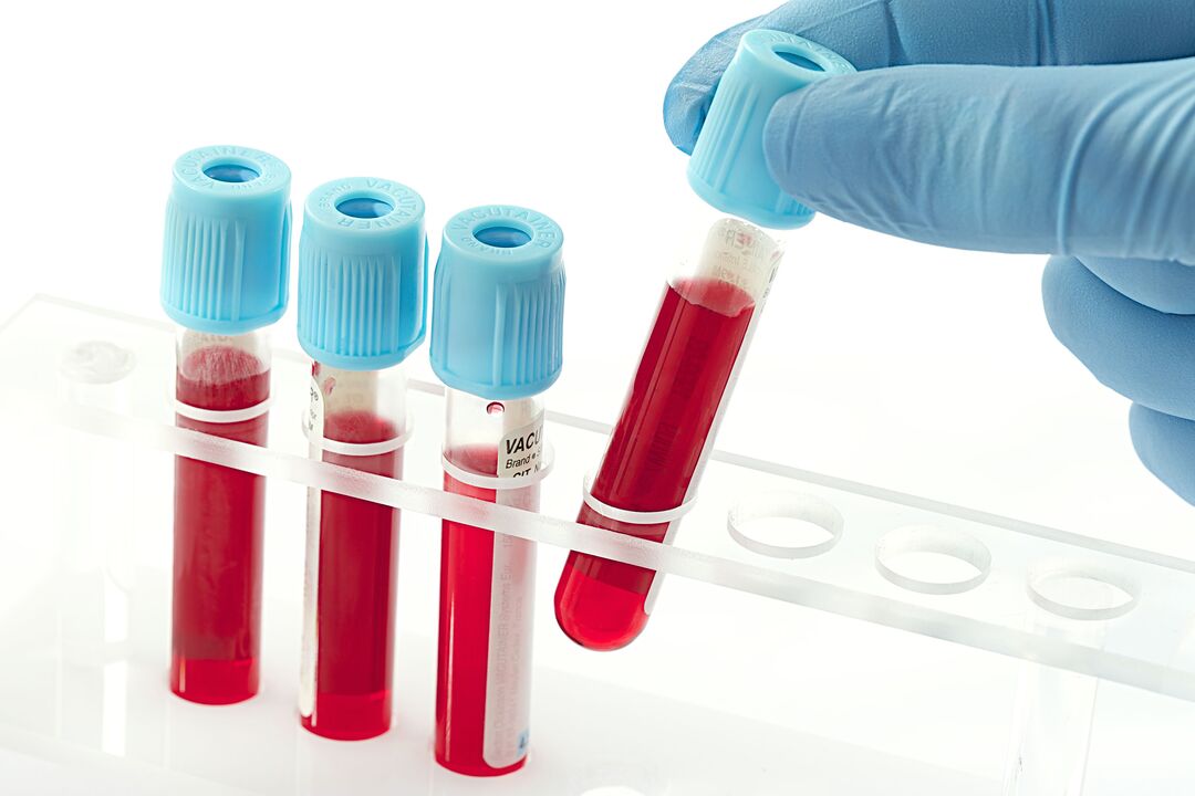 Bluttests zur Diagnose des humanen Papillomavirus