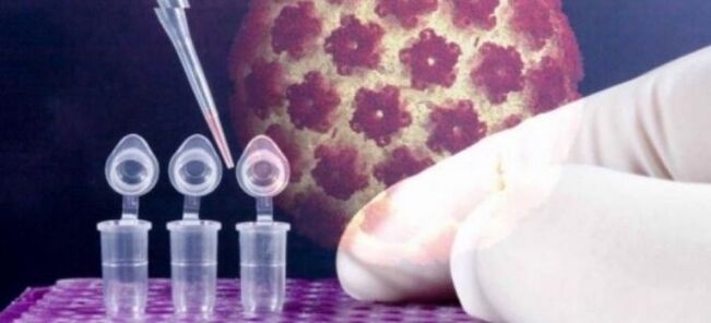 Diagnose von HPV mit dem Digene-Test